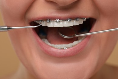 Photo of Examination of woman's teeth with braces using dental tools, closeup