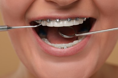 Examination of woman's teeth with braces using dental tools, closeup