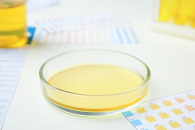 Photo of Petri dish with urine sample for analysis on white table