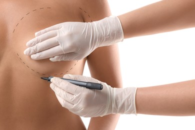 Breast augmentation. Doctor with marker preparing woman for plastic surgery operation against white background, closeup