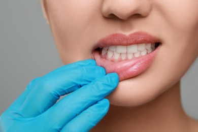 Photo of Doctor examining woman's gums on grey background, closeup