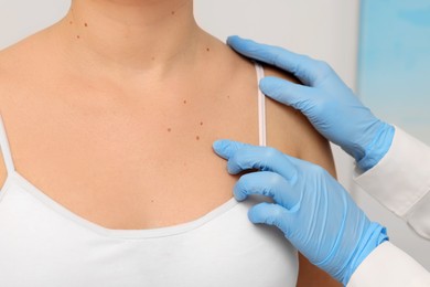 Dermatologist in rubber glove examining patient's birthmark on blurred background, closeup