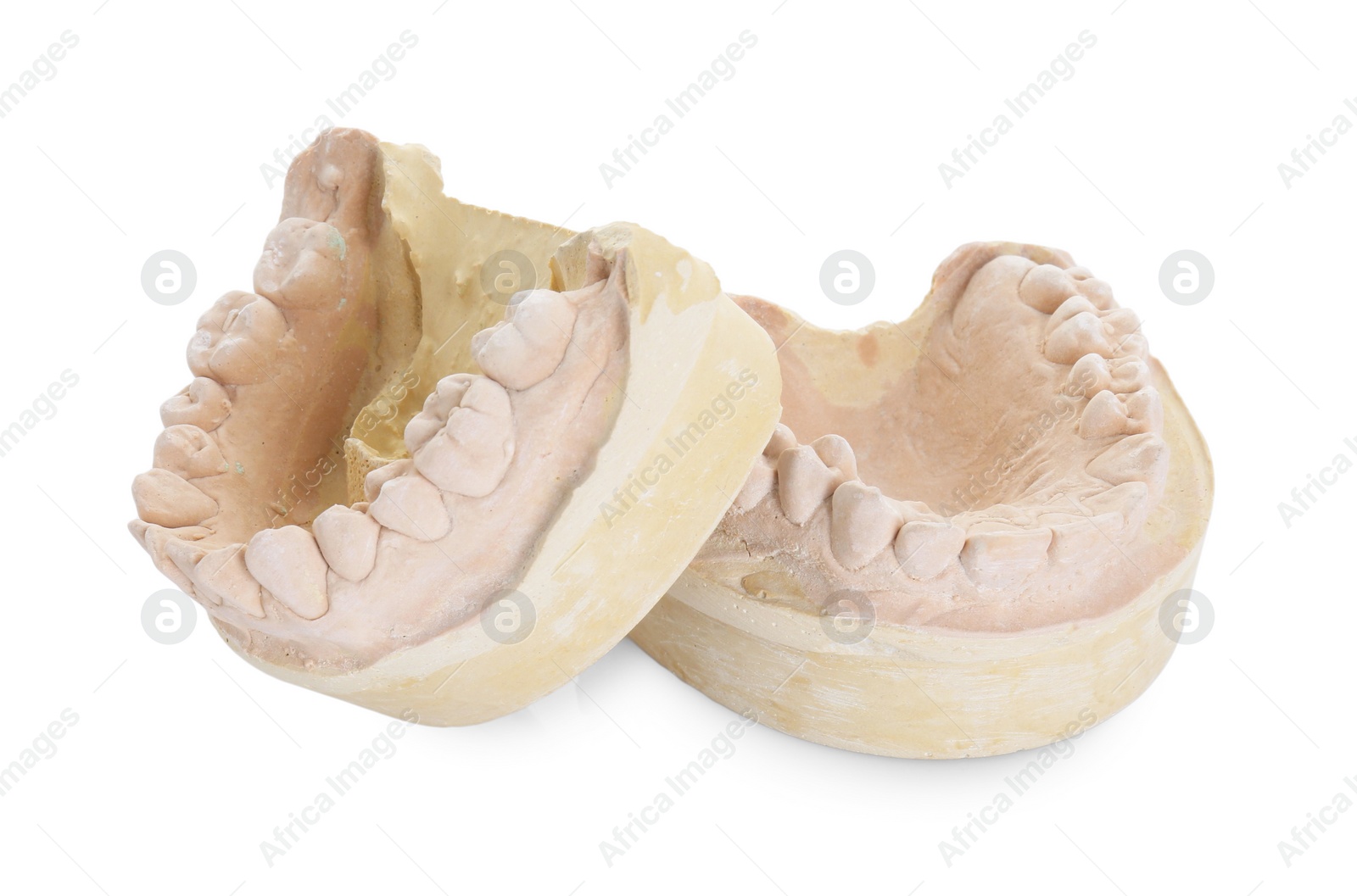 Photo of Dental model with jaws isolated on white. Cast of teeth