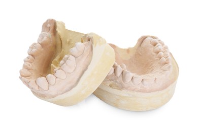 Dental model with jaws isolated on white. Cast of teeth