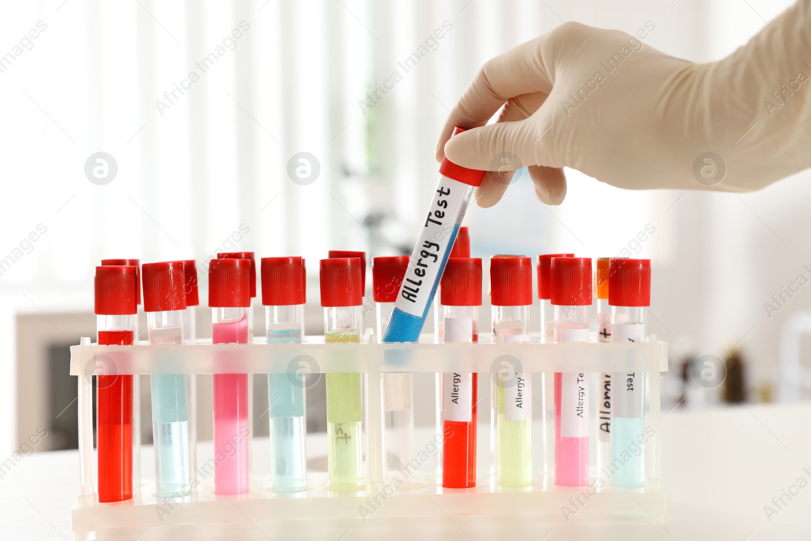 Photo of Doctor holding tube with label ALLERGY TEST over table, closeup