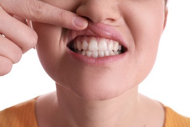 Photo of Woman showing gums on white background, closeup view