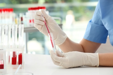 Scientist working with blood sample at table in laboratory