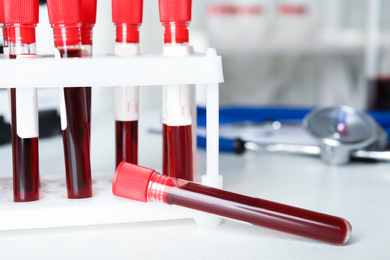 Photo of Test tubes with blood samples on light table, closeup. Virus research