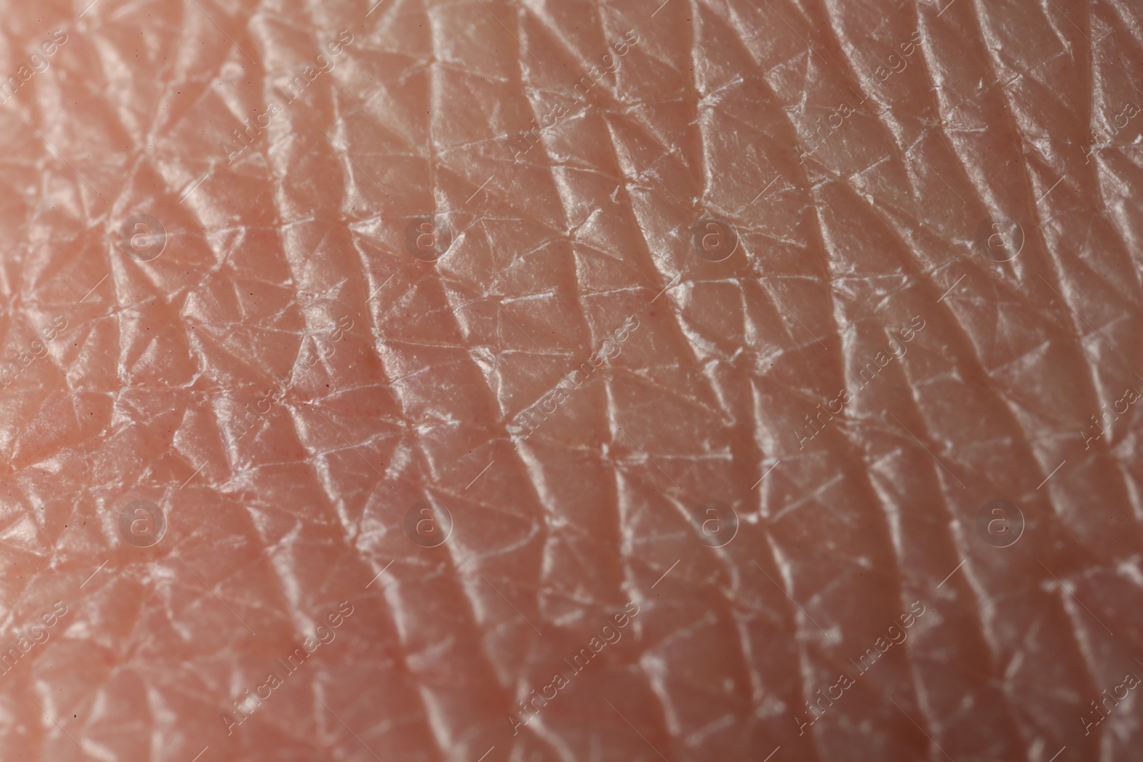 Photo of Texture of dry skin as background, macro view