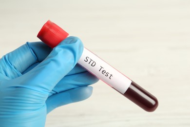 Photo of Scientist holding tube with blood sample and label STD Test on white background, closeup