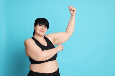 Photo of Obese woman with marks on body against light blue background, space for text. Weight loss surgery