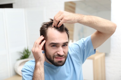 Photo of Young man with hair loss problem indoors
