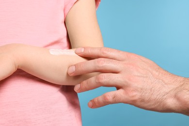 Father applying ointment onto his daughter's arm on light blue background, closeup