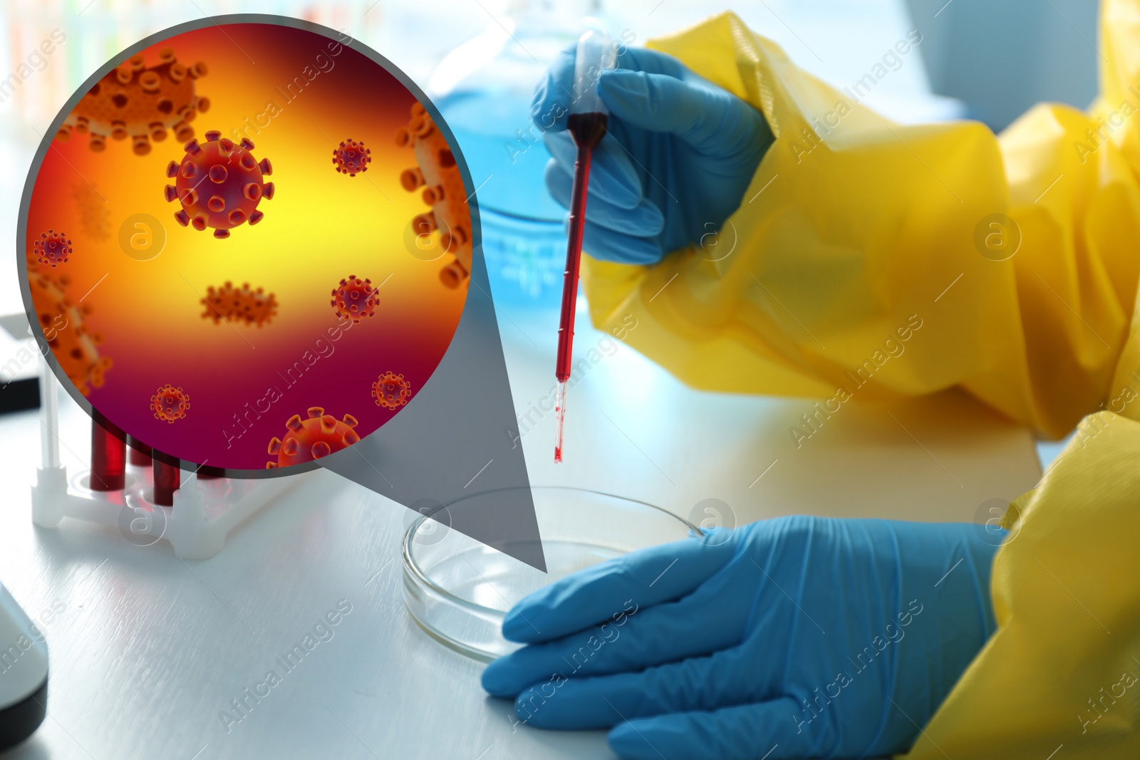 Image of Scientist in chemical protective suit dripping blood sample into Petri dish at table, closeup. Monkeypox virus