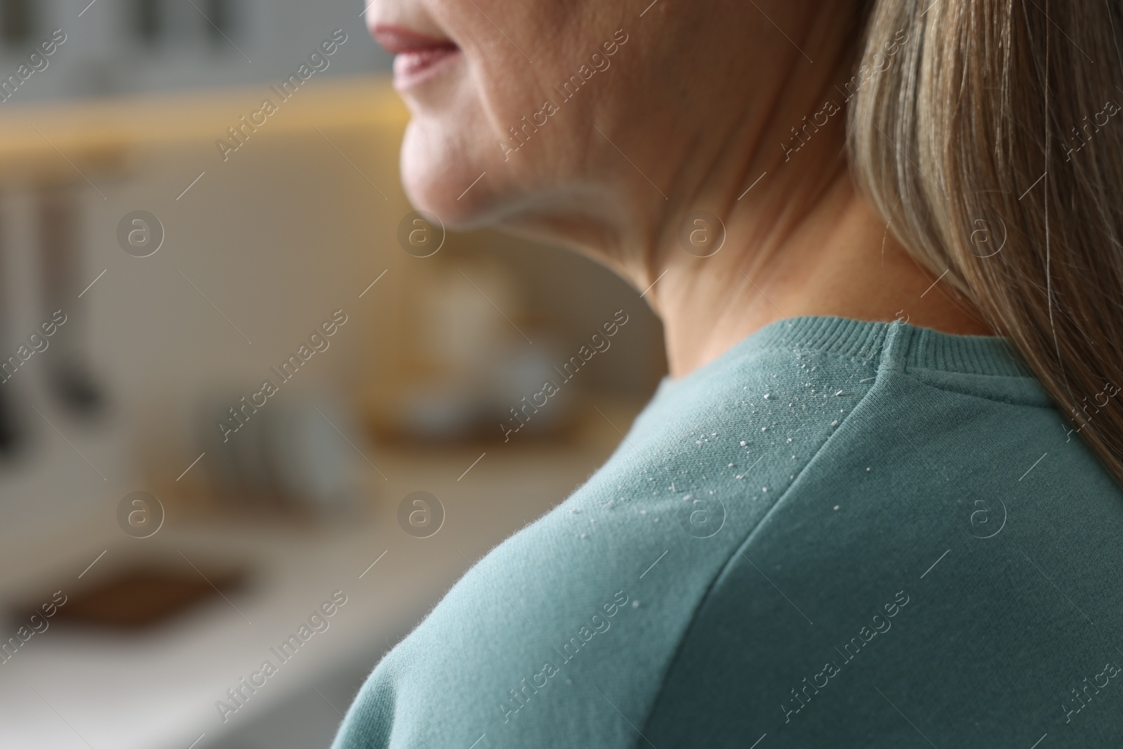 Photo of Woman with dandruff on her sweater indoors, closeup. Space for text