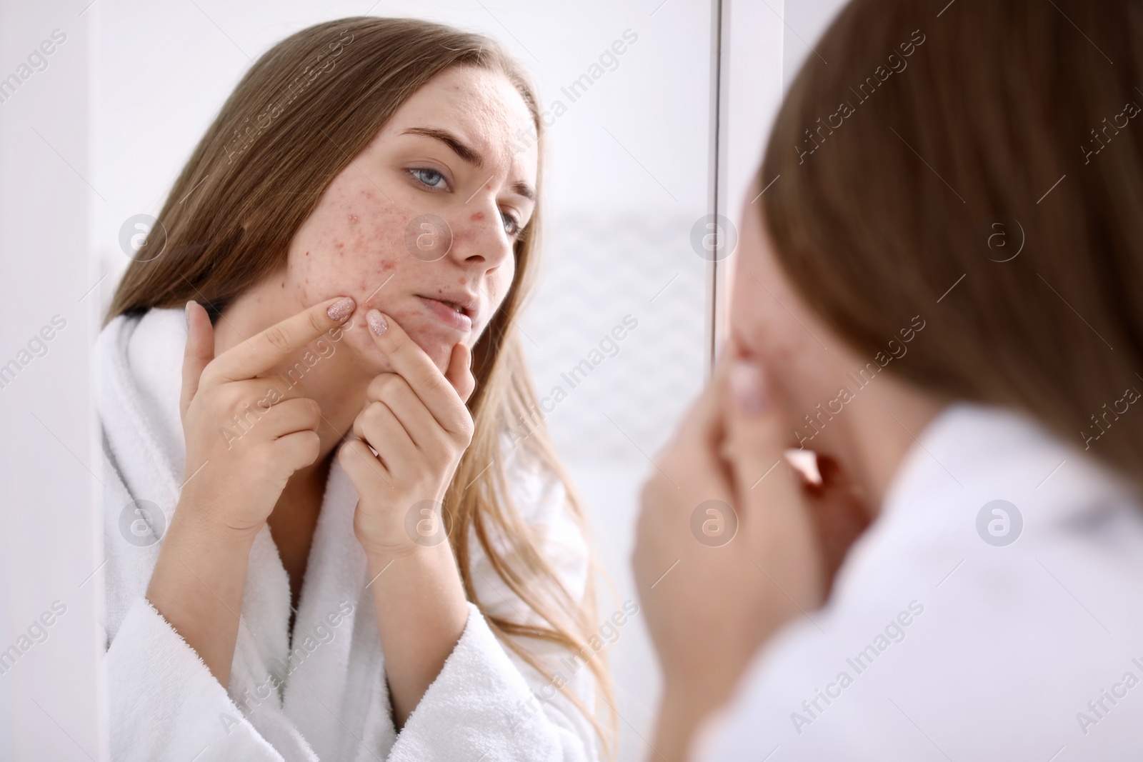 Photo of Young woman with acne problem near mirror in bathroom