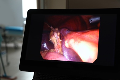 Displaying process of surgery on monitor in operating room