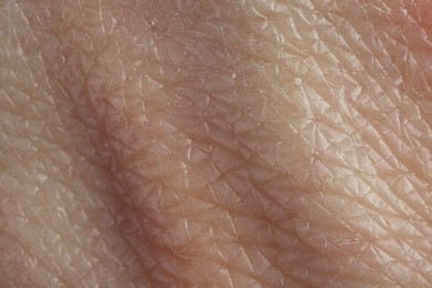 Texture of healthy skin as background, macro view