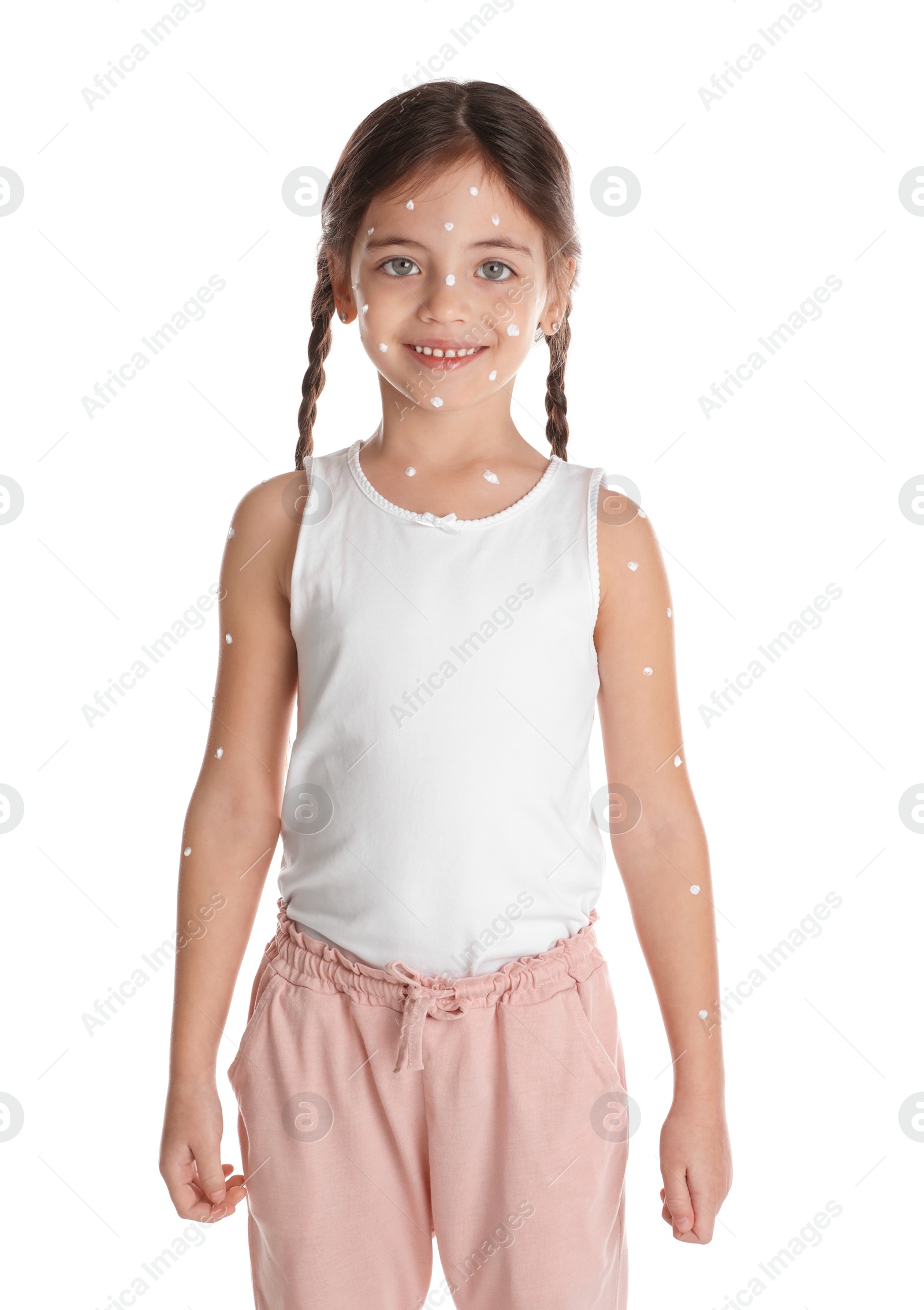 Photo of Little girl with chickenpox on white background