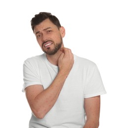 Man with rash suffering from monkeypox virus on white background
