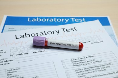 Photo of Liver Function Test. Tube with blood sample and laboratory forms on table