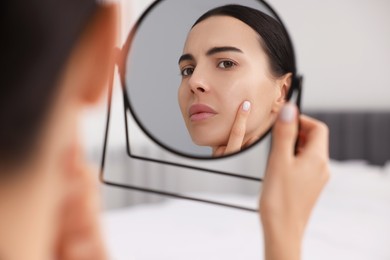 Woman with dry skin looking at mirror indoors