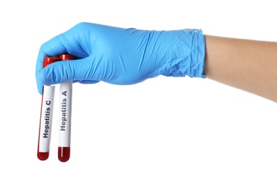 Photo of Scientist holding tubes with blood samples for hepatitis virus test on white background, closeup