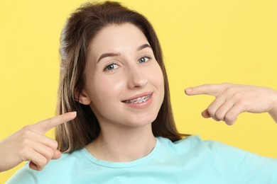 Photo of Smiling woman pointing at her dental braces on yellow background