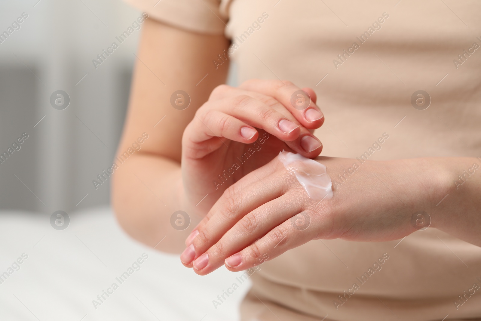 Photo of Young woman with dry skin applying cream onto her hand indoors, closeup