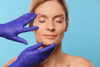 Doctor checking patient's face before cosmetic surgery operation on light blue background, closeup