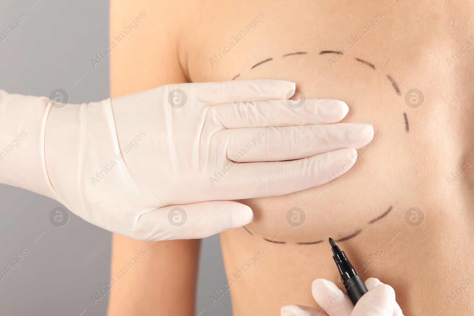 Photo of Doctor drawing marks on patient's breast for cosmetic surgery operation against gray background, closeup