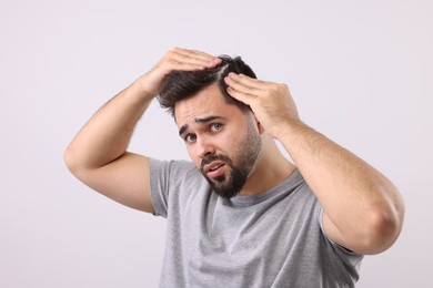 Photo of Emotional man with dandruff in his dark hair on light grey background