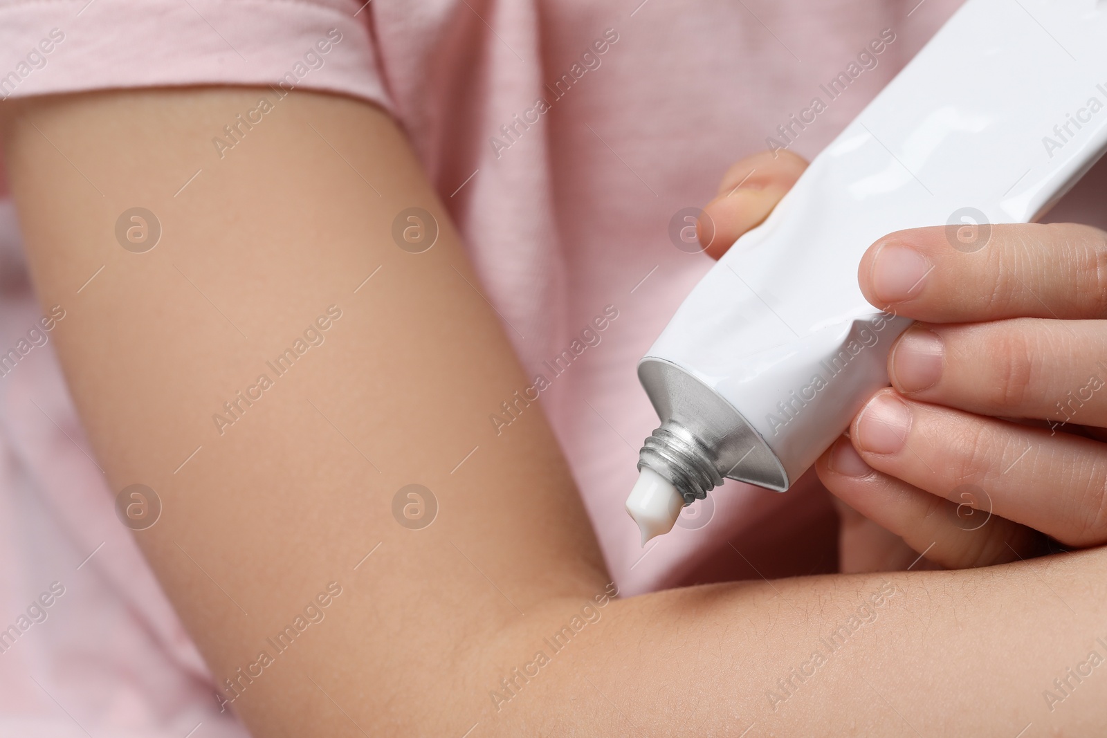 Photo of Little girl applying ointment onto her arm, closeup