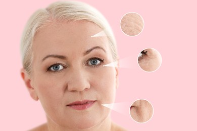 Beautiful mature woman on pink background. Zoomed skin areas showing wrinkles before rejuvenation procedures
