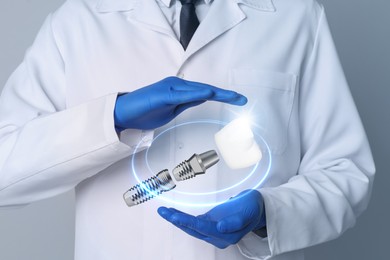 Doctor demonstrating dental implant on light background, closeup