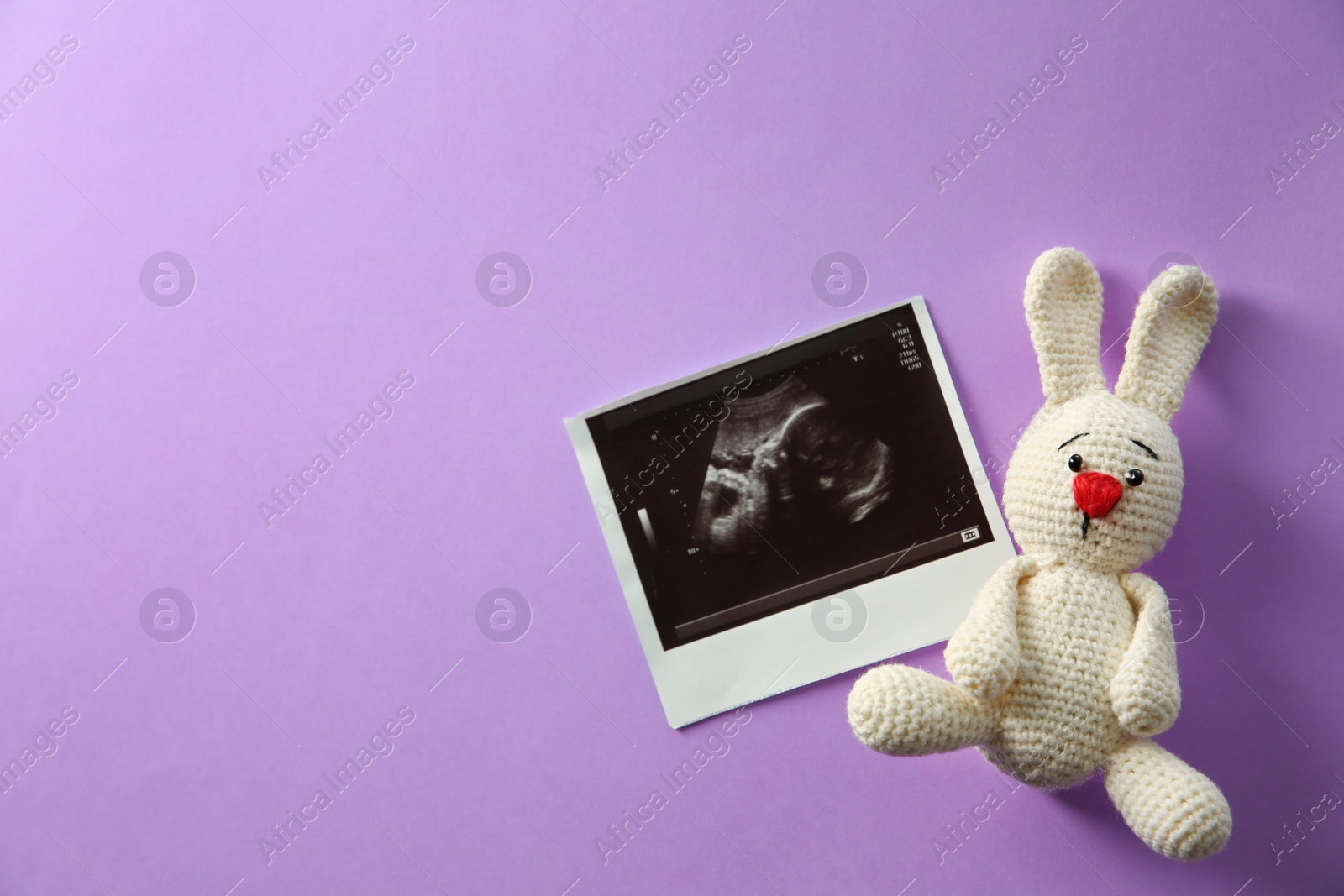 Photo of Ultrasound picture of baby and toy bunny on color background, top view with space for text