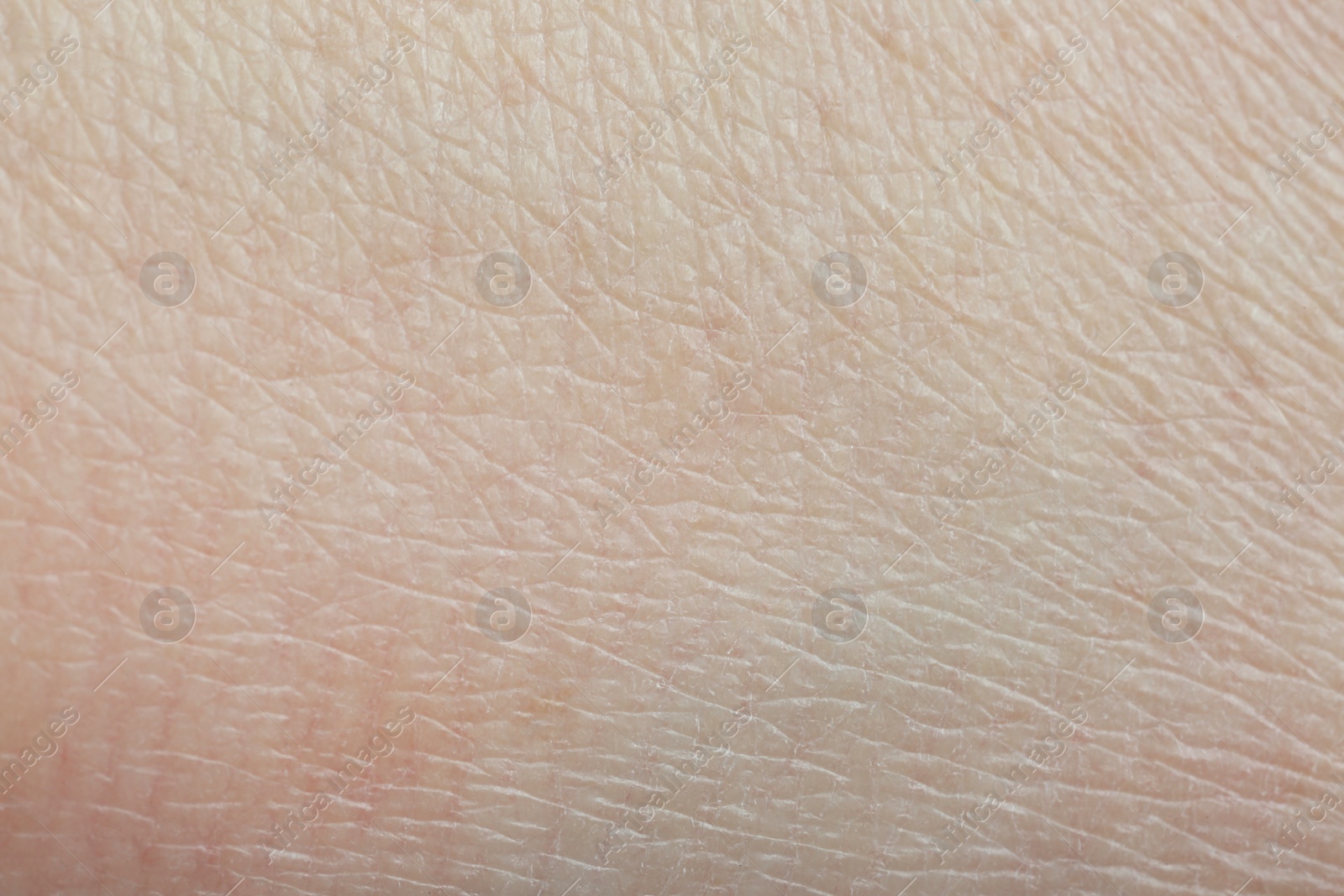 Photo of Texture of healthy skin as background, macro view