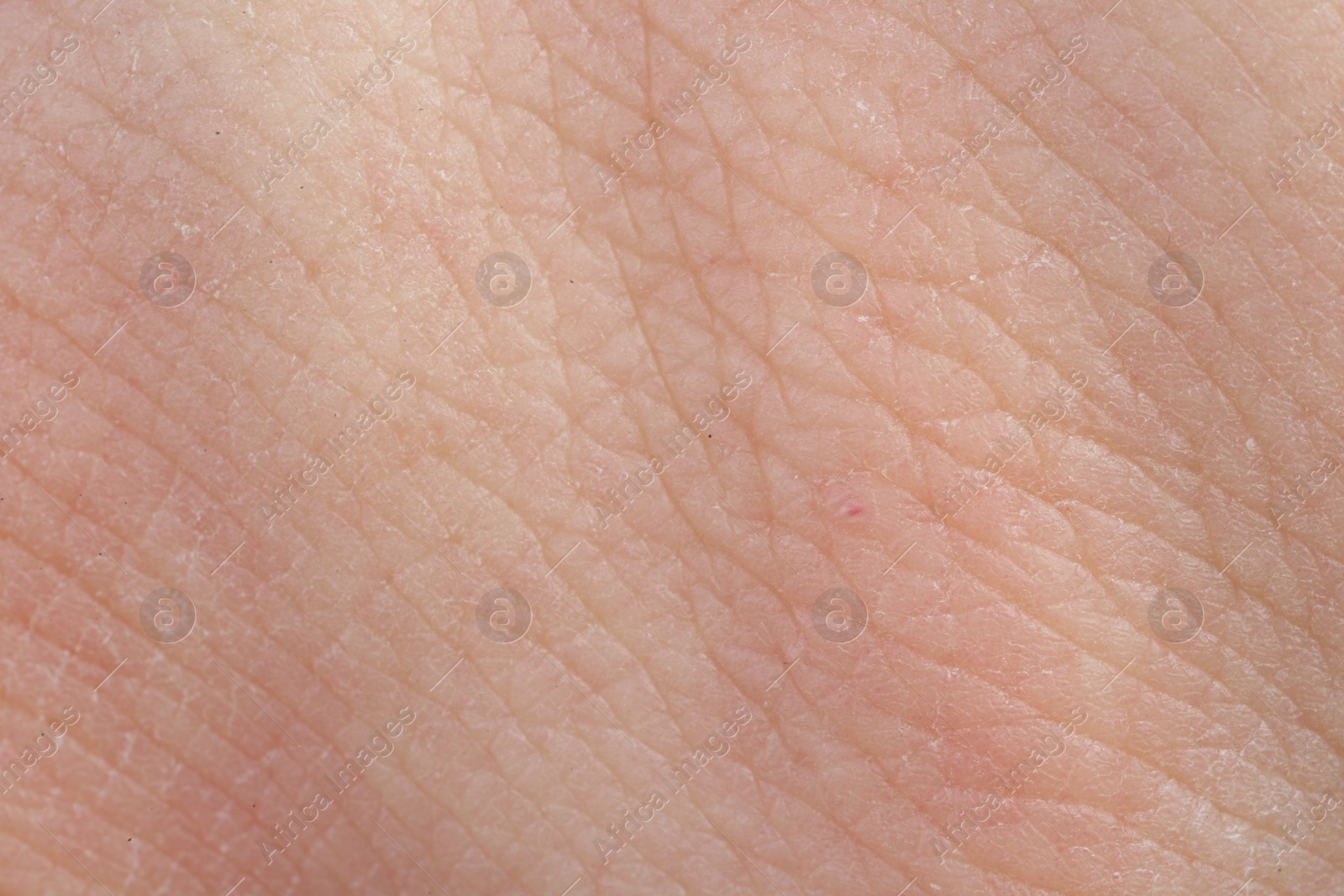 Photo of Texture of healthy skin as background, macro view