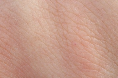 Photo of Texture of healthy skin as background, macro view