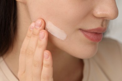 Photo of Young woman with dry skin applying cream onto her face, closeup