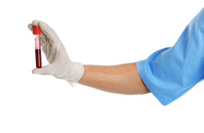 Male doctor holding test tube with blood sample on white background, closeup. Medical object