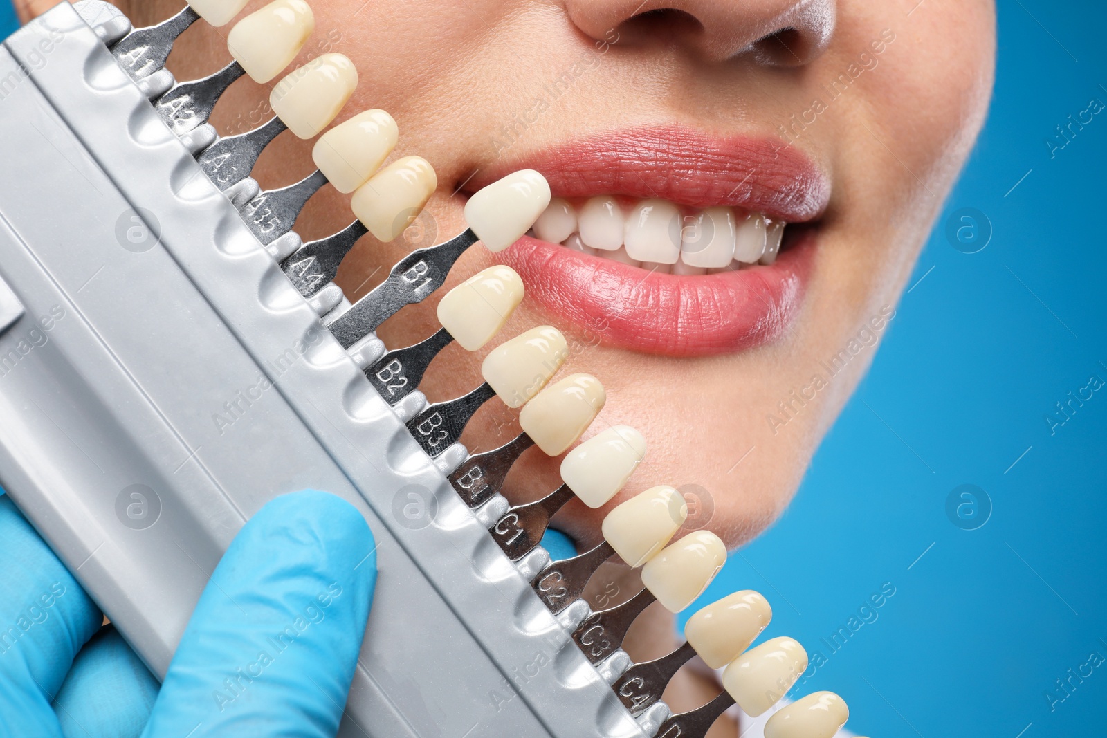 Photo of Doctor checking young woman's teeth color on blue background, closeup. Cosmetic dentistry