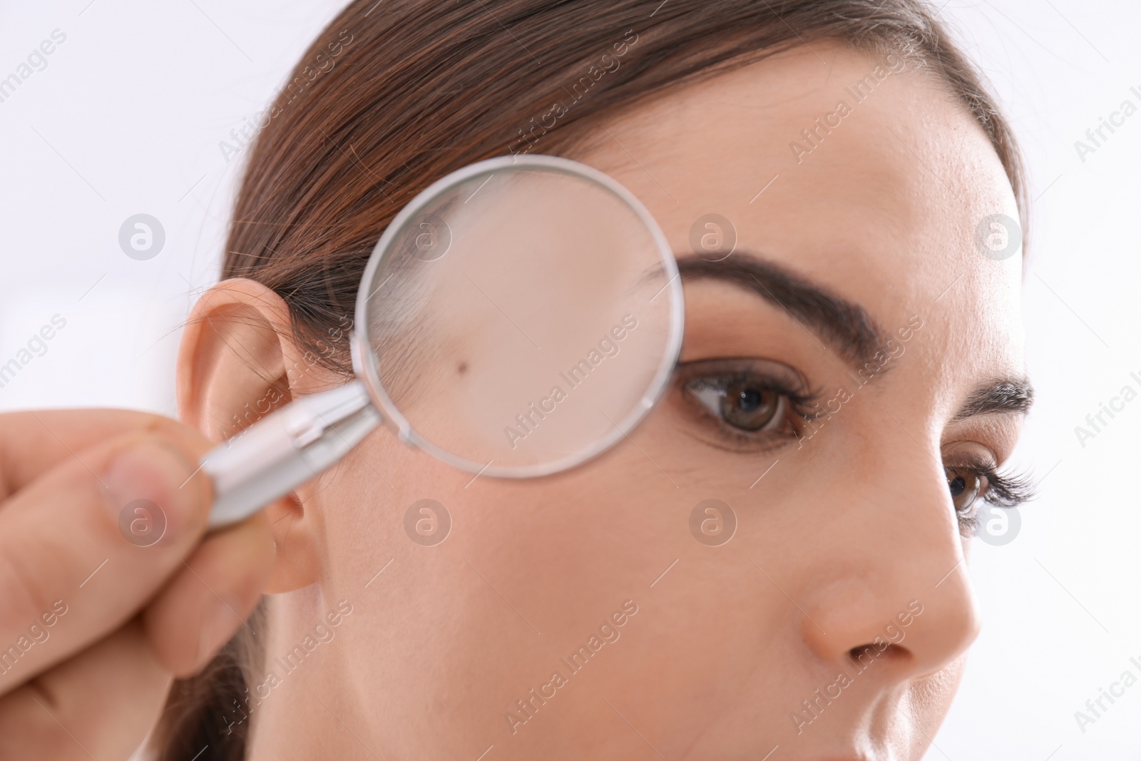 Photo of Dermatologist examining patient with magnifying glass in clinic, closeup view