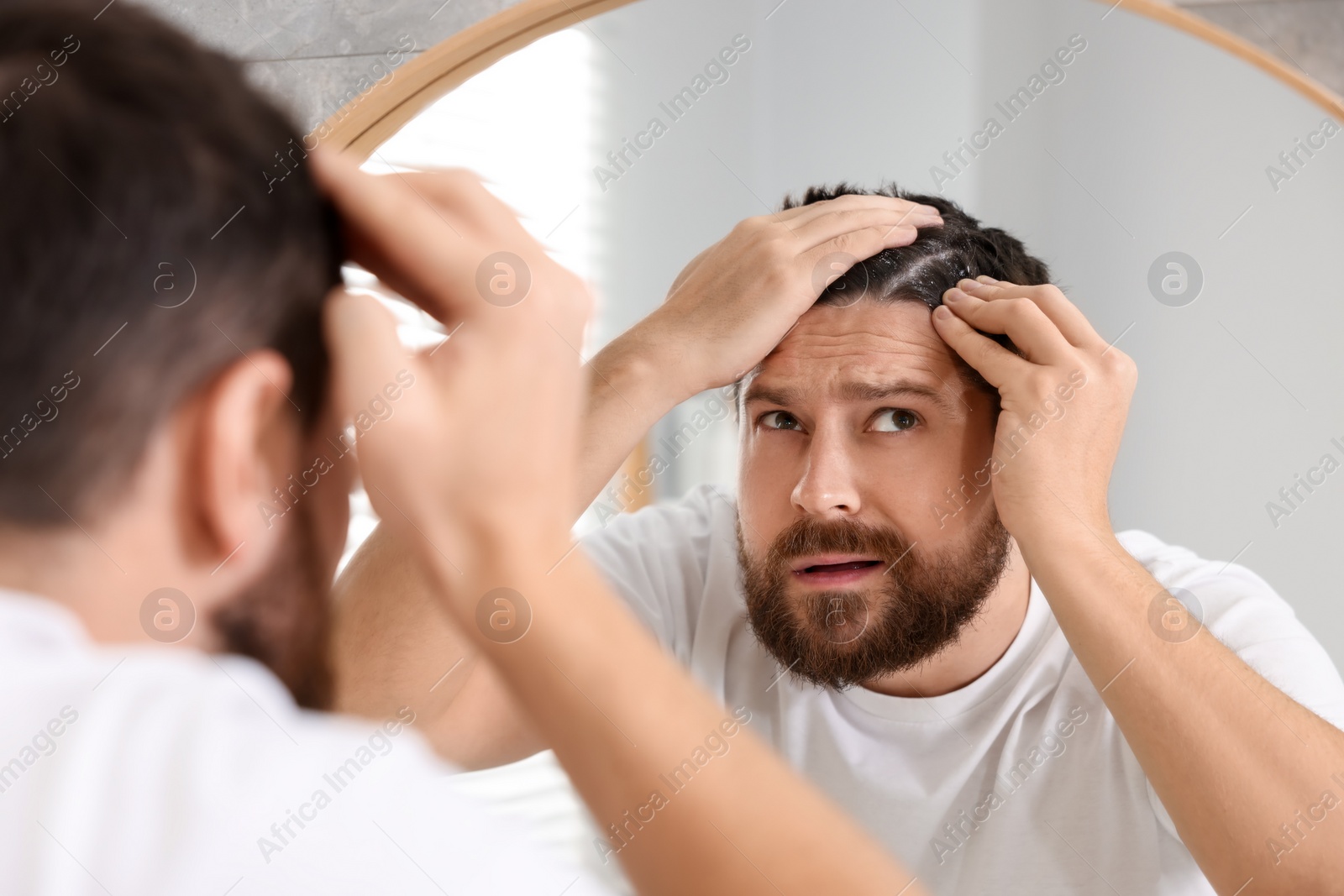 Photo of Man with dandruff in his dark hair near mirror indoors