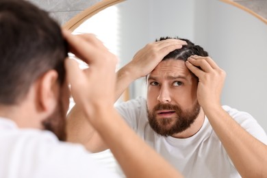 Photo of Man with dandruff in his dark hair near mirror indoors