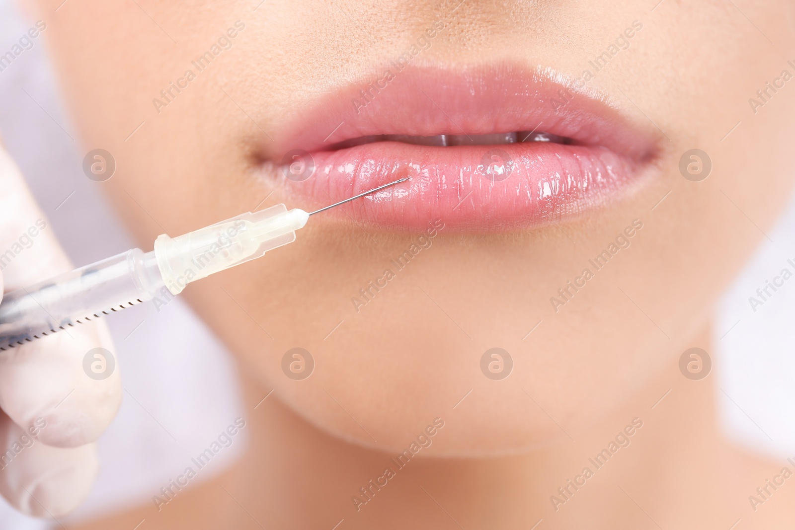 Photo of Young woman getting lip injection in beautician salon, closeup