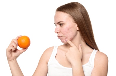 Young woman with acne problem holding orange on white background. Skin allergy