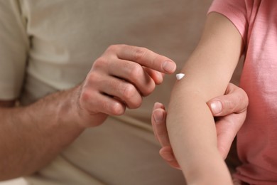 Photo of Father applying ointment onto his daughter's arm, closeup
