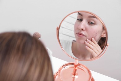 Photo of Woman with acne problem looking at mirror indoors