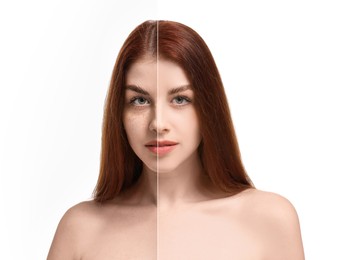 Image of Woman with freckles and clear skin on white background, collage